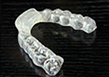 “B” Splints 2 “B” Splints 2