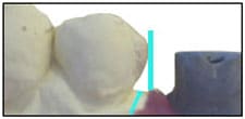 Fig. 1 Fig. 1
