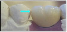 Fig. 2 Fig. 2