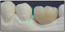 Fig. 3 Fig. 3