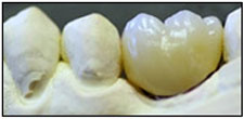 Fig. 4 Fig. 4