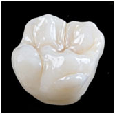 12--21 Layered Zirconia Crowns