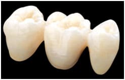 Full contour zirconia