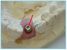 Figure 1 Figure 1