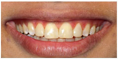 Case 2 Before Case 2 Before