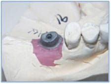 Figure 1 Figure 1