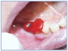 Figure 3 Figure 3