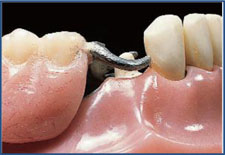 Figure 1 Figure 1