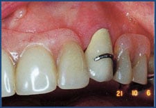 Figure 10 Figure 10