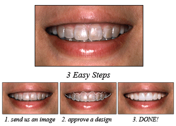 3 Easy Steps to Digital Smile Design 3 Easy Steps to Digital Smile Design