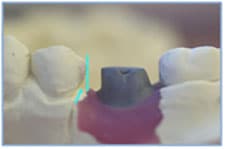 Figure 1 Figure 1