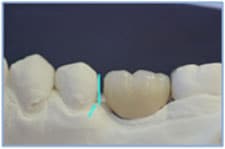 Figure 3 Figure 3