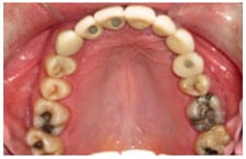 Post-Treatment Post-Treatment