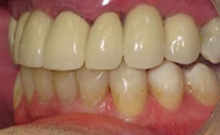 Post-Treatment 3 Post-Treatment 3
