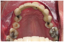 Pre-Treatment Pre-Treatment