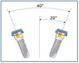 Divergences between two implants
