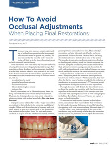 How to Avoid Occlusal Adjustments