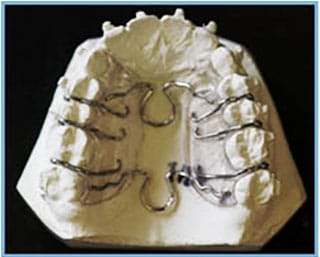 Orthodontics Band Orthodontics Band