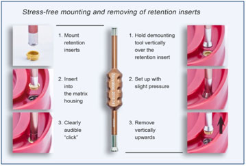Mounting & Removing Of Retention Inserts Mounting & Removing Of Retention Inserts