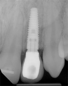 dr-caminschi--tooth-x-ray